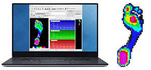 糖尿病足综合征的压力测量